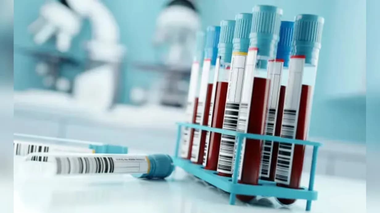 Blood test can predict lung cancer 5 years before diagnosis